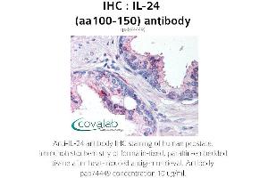 Image no. 1 for anti-Interleukin 24 (IL24) (AA 100-150) antibody (ABIN1735880) (IL-24 antibody  (AA 100-150))