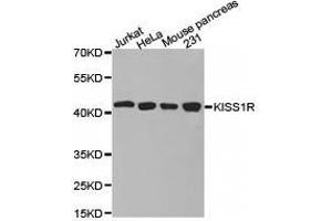 Western Blotting (WB) image for anti-KISS1 Receptor (KISS1R) antibody (ABIN1873420)