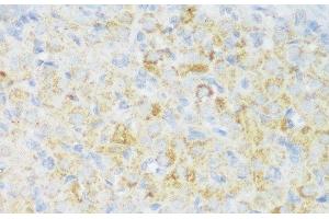 Immunohistochemistry of paraffin-embedded Rat ovary using CACNB3 Polyclonal Antibody at dilution of 1:150 (40x lens). (CACNB3 antibody)