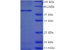 SDS-PAGE (SDS) image for Annexin A2 (ANXA2) (AA 2-339) protein (His-SUMO Tag) (ABIN5709043) (Annexin A2 Protein (ANXA2) (AA 2-339) (His-SUMO Tag))