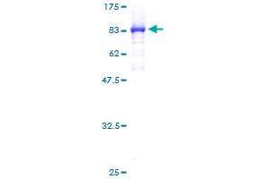 CCT5 Protein (AA 1-541) (GST tag)