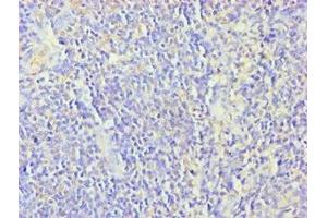 Immunohistochemistry of paraffin-embedded human tonsil tissue using ABIN7176252 at dilution of 1:100 (ZNF346 antibody  (AA 1-294))