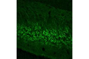 Indirect immunohystochemistry of a rat gyrus dentatus section (dilution 1 : 200). (NEFL antibody  (AA 1-284))