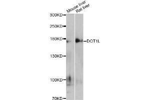Western blot analysis of extracts of various cell lines, using DOT1L antibody (ABIN5997614) at 1/500 dilution.