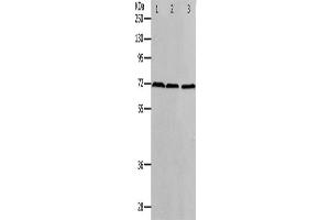 Western Blotting (WB) image for anti-Protein Arginine Methyltransferase 5 (PRMT5) antibody (ABIN2426359) (PRMT5 antibody)