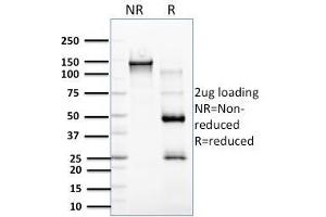 SDS-PAGE Analysis Purified RCAS1 Mouse Monoclonal Antibody (CPTC-EBAG9-2). (RCAS1 antibody)