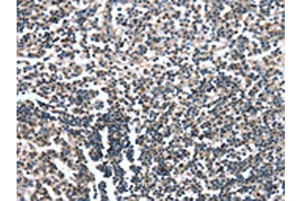 CAMTA1 antibody