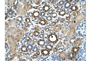 Immunohistochemistry (IHC) image for anti-Suppression of Tumorigenicity 14 (Colon Carcinoma) (ST14) (C-Term) antibody (ABIN2773910) (ST14 antibody  (C-Term))