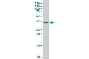 LGALS9 polyclonal antibody (A01), Lot # 050928JC01 Western Blot analysis of LGALS9 expression in Jurkat . (Galectin 9 antibody  (AA 254-355))