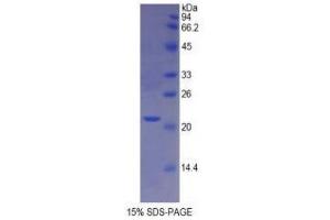 SDS-PAGE (SDS) image for Involucrin (IVL) (AA 301-460) protein (His tag) (ABIN2121469) (Involucrin Protein (IVL) (AA 301-460) (His tag))