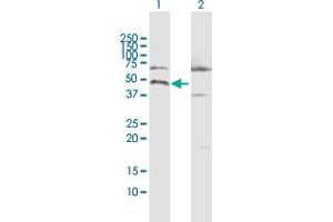Western Blot analysis of CALU expression in transfected 293T cell line by CALU MaxPab polyclonal antibody. (CALU antibody  (AA 1-315))
