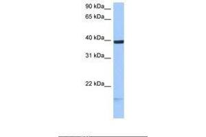 HS3ST5 antibody  (C-Term)