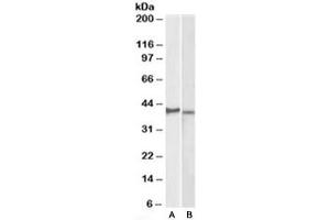 Western blot testing of KELLY [A] and U251-MG [B] lysates with CX3CR1 antibody at 2ug/ml. (CX3CR1 antibody)