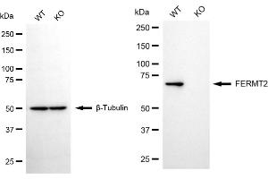 Western blotting analysis using FERMT2 antibody (ABIN7798592).