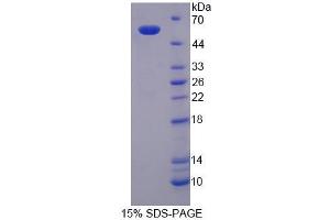 SDS-PAGE (SDS) image for Serine Palmitoyltransferase, Long Chain Base Subunit 3 (SPTLC3) (AA 80-563) protein (His tag) (ABIN6237535) (SPTLC3 Protein (AA 80-563) (His tag))