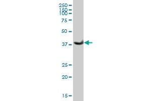 ADH1B MaxPab polyclonal antibody. (ADH1B antibody  (AA 1-375))