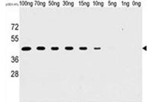 Western blot analysis of H1L antibody and recombinant H1L protein. (Tyr/ser Protein Phosphatase antibody)