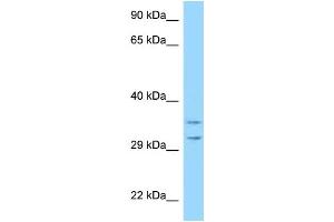 WB Suggested Anti-RPS2 Antibody Titration: 1.