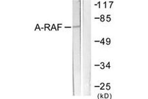 Western blot analysis of extracts from HeLa cells, treated with PMA 125ng/ml 30', using A-RAF (Ab-301/302) Antibody.