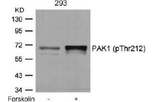 Image no. 1 for anti-P21-Activated Kinase 1 (PAK1) (pThr212) antibody (ABIN196879) (PAK1 antibody  (pThr212))