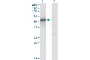 Western Blotting (WB) image for anti-Friend Leukemia Virus Integration 1 (FLI1) (AA 1-452) antibody (ABIN515741)