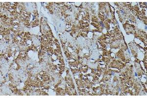 Immunohistochemistry (Paraffin-embedded Sections) (IHC (p)) image for anti-FK506 Binding Protein 1B, 12.6 KDa (FKBP1B) antibody (ABIN7259090)