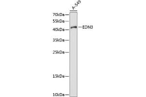 Western blot analysis of extracts of A-549 cells, using EDN3 antibody (ABIN6127870, ABIN6139934, ABIN6139936 and ABIN6214707) at 1:1000 dilution. (Endothelin 3 antibody  (AA 17-187))