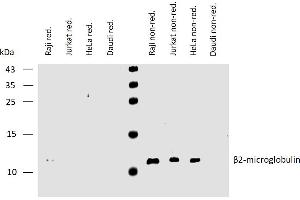 Western Blotting (WB) image for anti-beta-2-Microglobulin (B2M) antibody (ABIN93903)