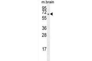 FBXO21 Antibody (C-term) (ABIN655273 and ABIN2844865) western blot analysis in mouse brain tissue lysates (35 μg/lane).