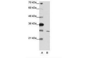 Image no. 2 for anti-Zinc Finger Protein 397 (ZNF397) (C-Term) antibody (ABIN202144)