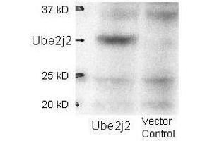 Western blot using  affinity purified anti-Ube2j2 antibody shows detection of Ube2j2 in 293 cells over-expressing Myc-Ube2j2 (Lane 1).