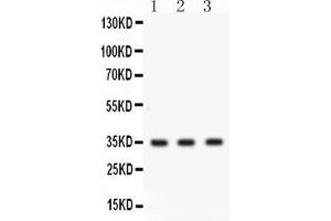 Western blot analysis of Cathepsin G expression in COLO320 whole cell lysates ( Lane 1), MCF-7 whole cell lysates ( Lane 2) and U20S whole cell lysates ( Lane 3).