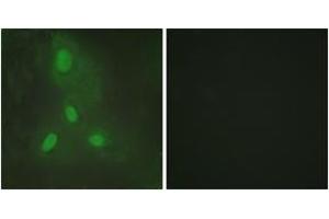 Immunofluorescence analysis of HeLa cells, using BACH1 Antibody. (BACH1 antibody  (AA 131-180))