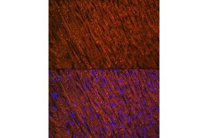 Immunohistochemistry of paraffin-embedded human colon using Desmin Rabbit mAb (ABIN1678733, ABIN3018020, ABIN3018021 and ABIN7101569) at dilution of 1:100 (40x lens). (Desmin antibody)