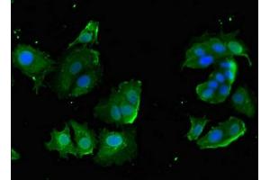 Immunofluorescent analysis of MCF-7 cells using ABIN7149214 at dilution of 1:100 and Alexa Fluor 488-congugated AffiniPure Goat Anti-Rabbit IgG(H+L) (Cytochrome P450, Family 2, Subfamily A, Polypeptide 1 (CYP2A1) (AA 91-390) antibody)