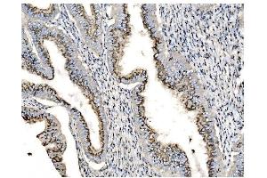 IHC analysis of GOLPH2/GOLM1 using anti-GOLPH2/GOLM1 antibody (ABIN7601505).