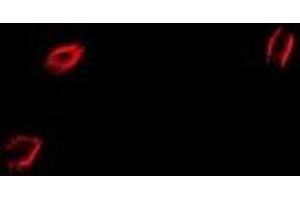 Immunofluorescent analysis of CapZ alpha-2 staining in HepG2 cells. (CAPZA2 antibody)