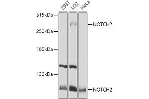 Western blot analysis of extracts of various cell lines, using NOTCH2 antibody (ABIN6132419, ABIN6144736, ABIN6144737 and ABIN6213887) at 1:1000 dilution. (NOTCH2 antibody  (AA 2242-2471))