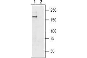 Western blot analysis of rat brain membrane: - 1. (SCN11A antibody  (C-Term, Intracellular))