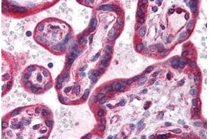 Human Placenta (formalin-fixed, paraffin-embedded) stained with HIF3A antibody ABIN214599 at 5 ug/ml followed by biotinylated goat anti-rabbit IgG secondary antibody ABIN481713, alkaline phosphatase-streptavidin and chromogen. (HIF3A antibody  (AA 581-592))