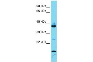 Host: Rabbit  Target Name: Fam133b  Sample Tissue: Mouse Thymus lysates  Antibody Dilution: 1. (FAM133B antibody  (Middle Region))