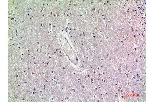 Immunohistochemistry (IHC) analysis of paraffin-embedded Human Brain, antibody was diluted at 1:200. (GDF7 antibody  (Internal Region))