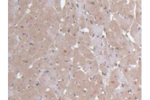IHC-P analysis of Rat Heart Tissue, with DAB staining. (Ninein antibody  (AA 1-153))