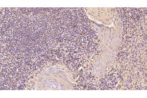 Detection of CD63 in Human Spleen Tissue using Monoclonal Antibody to Tetraspanin 30Cluster of Differentiation 63 (CD63) (CD63 antibody  (AA 103-203))