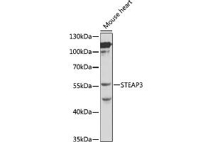 Western blot analysis of extracts of mouse heart, using STE antibody (ABIN3021067, ABIN3021068, ABIN3021069 and ABIN6213936) at 1:1000 dilution.