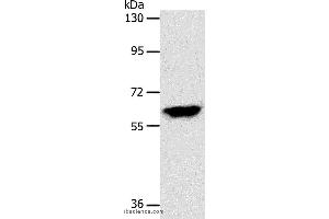 Western blot analysis of Mouse brain tissue, using INA Polyclonal Antibody at dilution of 1:500 (INA antibody)