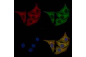 Phospho-Ezrin (Thr567) Mouse Monoclonal Antibody staining Hela cells by IF/ICC.