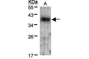 Image no. 2 for anti-V-Crk Sarcoma Virus CT10 Oncogene Homolog (Avian) (CRK) (AA 122-302) antibody (ABIN467422) (Crk antibody  (AA 122-302))