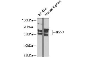 Western blot analysis of extracts of various cell lines, using IKZF3 Antibody (ABIN6130489, ABIN6142290, ABIN6142291 and ABIN6223116) at 1:1000 dilution. (IKZF3 antibody  (AA 280-450))