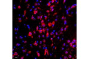 Immunofluorescence of paraffin embedded mouse corpus striatum using WDR81 (ABIN7076221) at dilution of 1: 700 (400x lens) (WDR81 antibody)